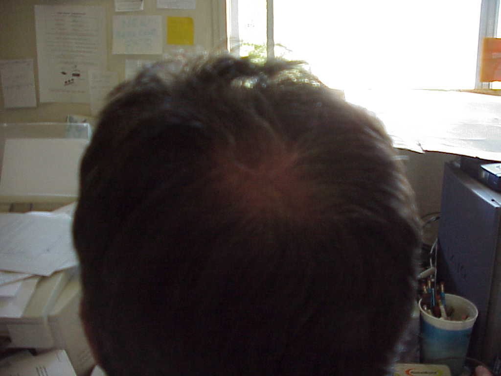 myhair.jpg